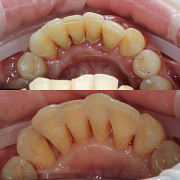 Професійне шинування зубів у Хмельницькому: Зробіть перший крок до здорової посмішки! Хмельницкий