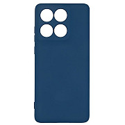 Чохол ArmorStandart ICON Camera Cov для Motorola Edge 60 Fusion 5G Dark Blue (ARM85593) (Код товару: Харьков
