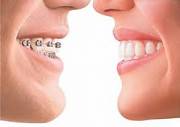 Ортодонтия в стоматологии ДСС Бровары