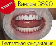 Виниры Киев 3890 грн. по Акции Киев