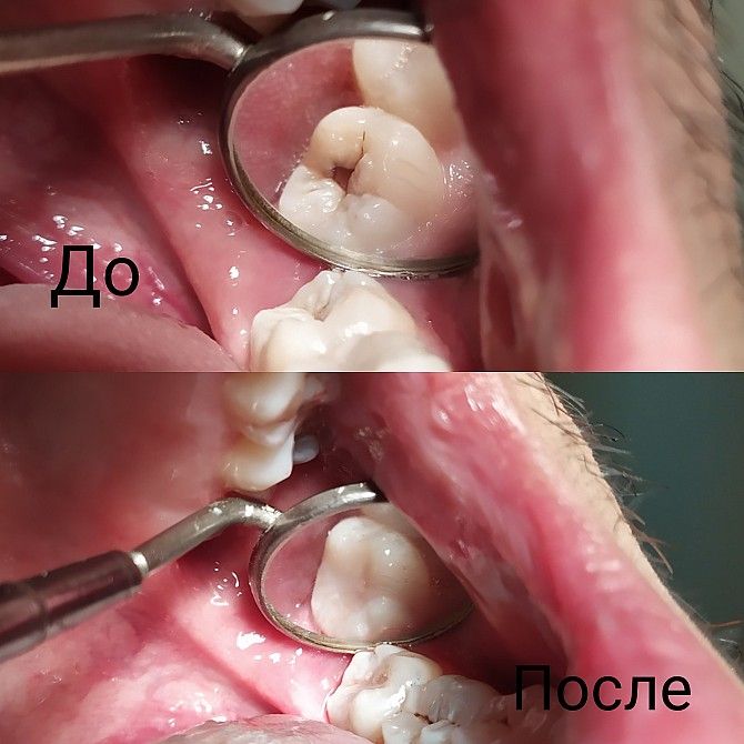 Врач - стоматолог , г. Одесса Одесса - изображение 1