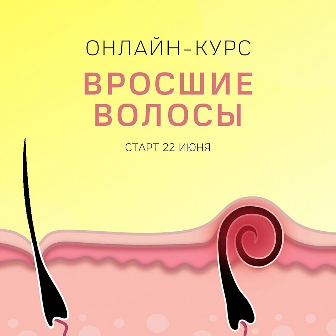 Онлайн-курс: Вросшие волосы Запорожье - изображение 1