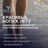 Лечение варикозного расширения вен - ЭВЛК, Харьков Харьков
