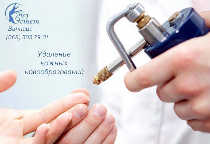 Удалить удаление папиломы родинки бородавки Винница Косметология Винница - изображение 1