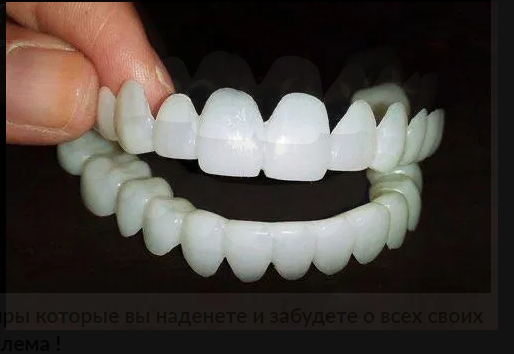 Виниры Snap on smile подойдут всем Верх и НИЗ Лисичанск - изображение 1