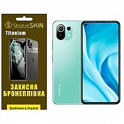 Поліуретанова плівка StatusSKIN Titanium на екран Xiaomi Mi 11 Lite/11 Lite 5G Глянцева (Код товару: Харьков