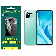 Поліуретанова плівка StatusSKIN Ultra на корпус Xiaomi 11 Lite 5G Глянцева (Код товару:26875) Харьков