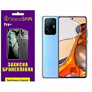 Поліуретанова плівка StatusSKIN Pro+ на экран Xiaomi 11T/11T Pro Глянцева (Код товару:27091) Харьков