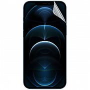 StatusSKIN Плівка Hydrogel UV-SHAPED для смартфона (Матова) (Код товару:29803) Харьков